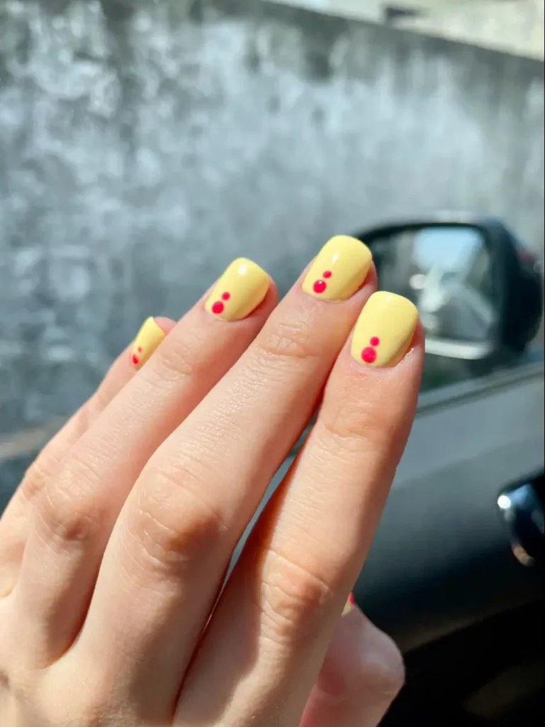 Gelbe Nägel loswerden: 16 Tipps gegen Verfärbungen & Ursachen