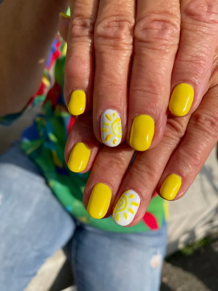 Gelbe Nägel loswerden: 16 Tipps gegen Verfärbungen & Ursachen