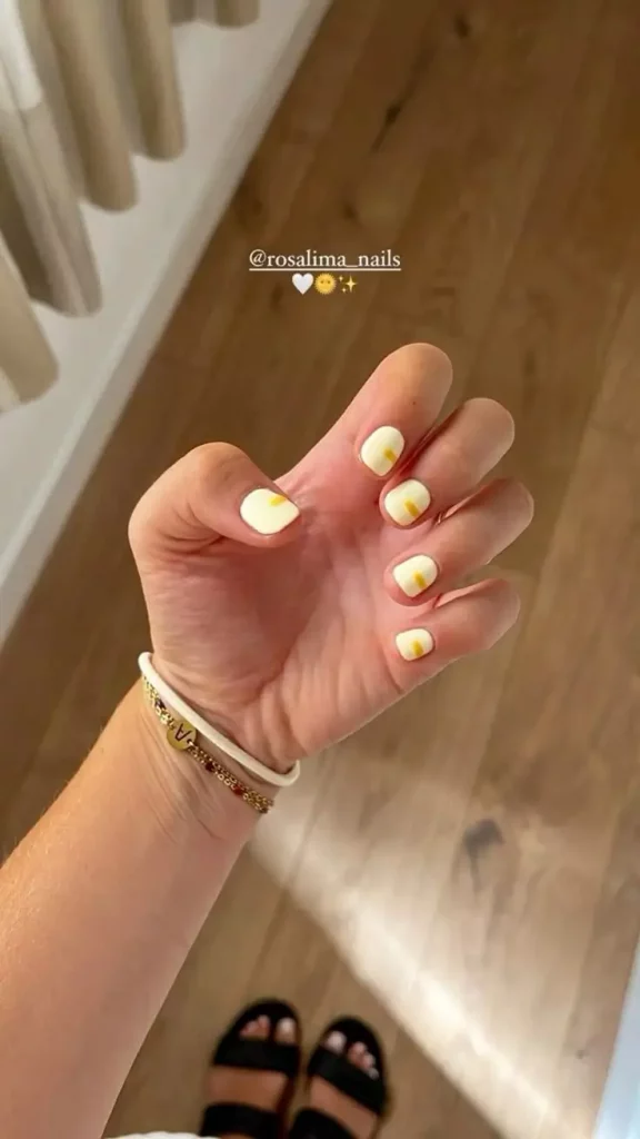 Gelbe Nägel loswerden: 16 Tipps gegen Verfärbungen & Ursachen